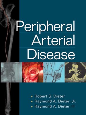 cover image of Peripheral Arterial Disease